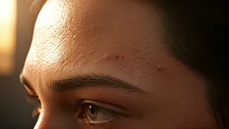 Humidity And Acne Share A Complicated Connection