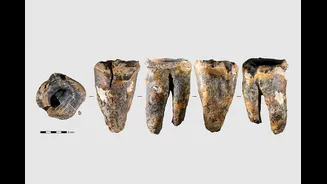 Dentistas pré-históricos? Neandertais podem ter removido cáries com ferramentas de pedra