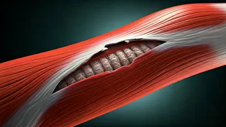 Rhabdomyolysis: Causes, Symptoms, and Athlete Risks