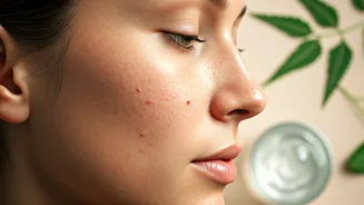 How To Prevent Monsoon Breakouts Naturally