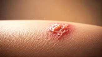 Over-Exfoliating Could Be Damaging Your Skin Barrier