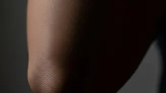 Lighten Dark Elbows and Knees Naturally