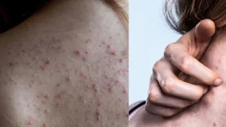 Homemade Oil Fades Back Spots For Clear Skin