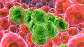 Tired Skin? Zombie Cells May Be The Cause.