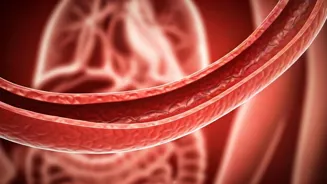 Clean Arteries Naturally For A Healthy Heart