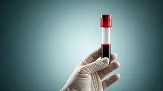 Blood Test May Predict Brain Disease Early