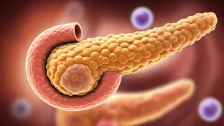 Type 2 Diabetes: Understand the Causes