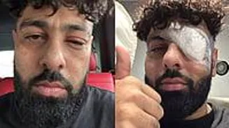 Badshah Has Eye Surgery After Stage Injury