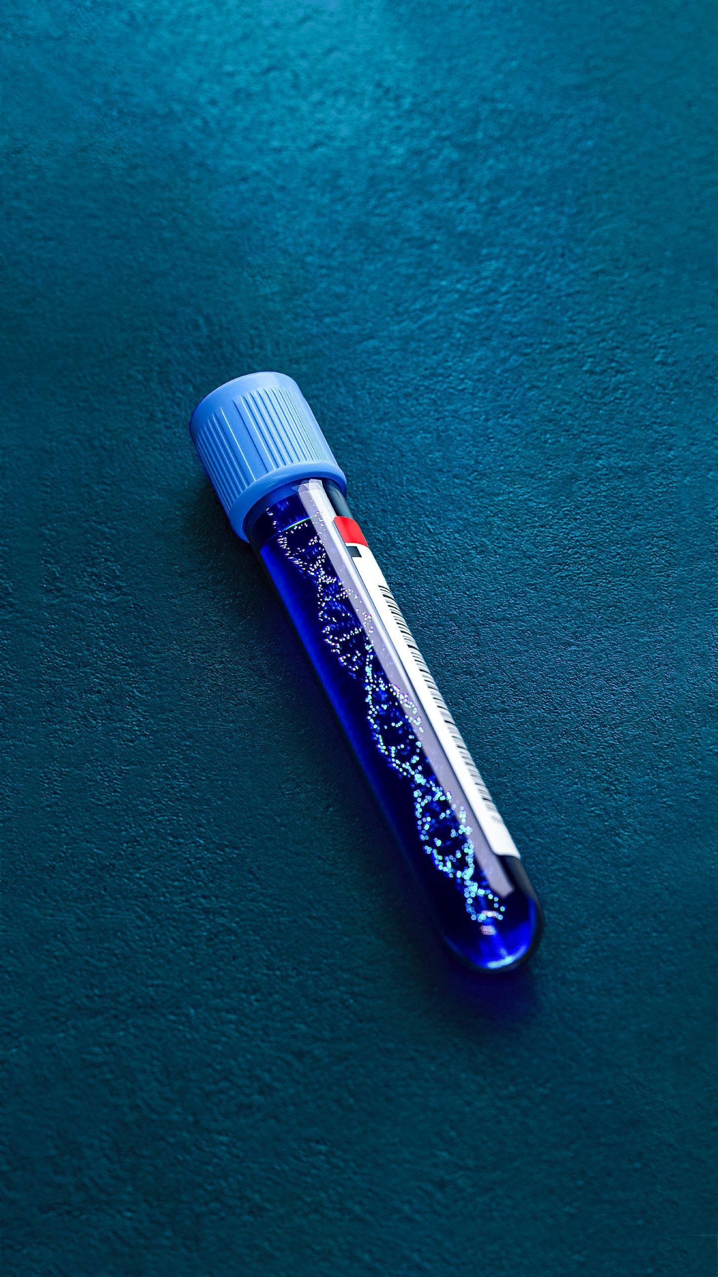 Research Team Develops DNA Test to Predict Antidepressant Effectiveness