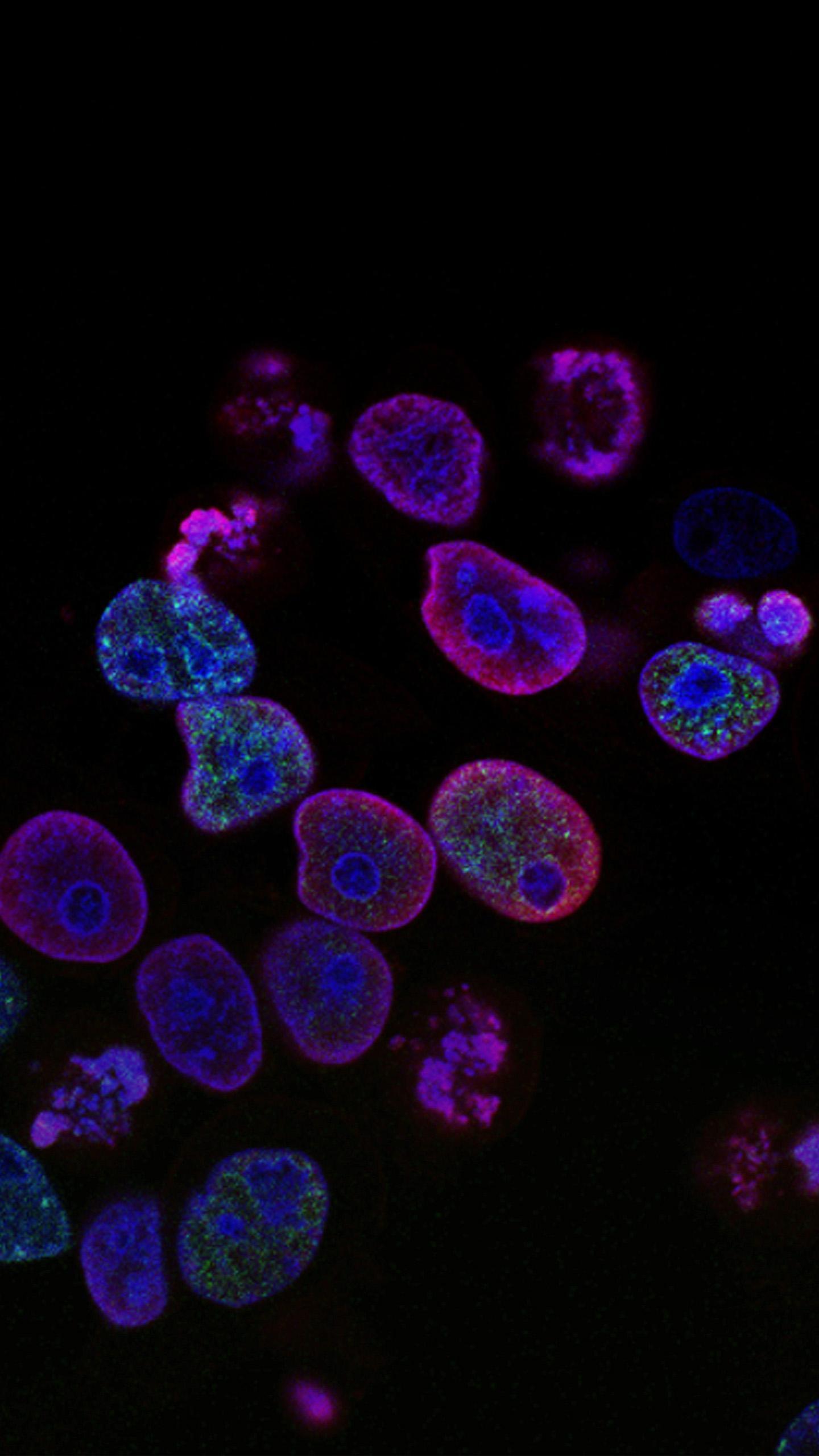 Cardiac Fibroblast Growth Factor-23 Deletion Alters Energy Metabolism in Heart Disease